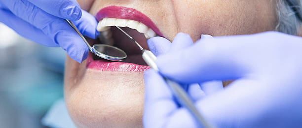 Best Emergency Denture Repair in Belle Mead, NJ